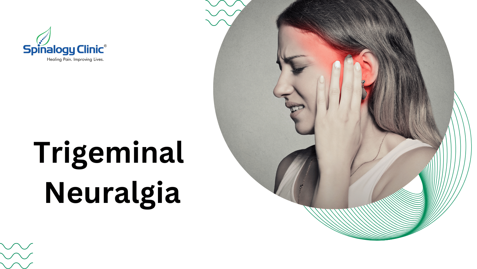 Trigeminal Neuralgia